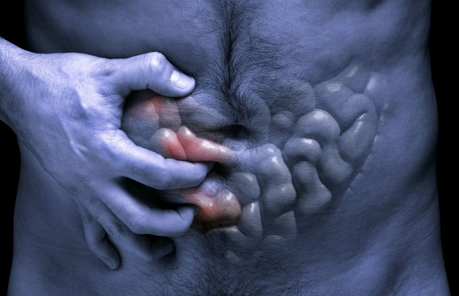 Confirmation du lien entre la maladie de Crohn et la spondyloarthrite