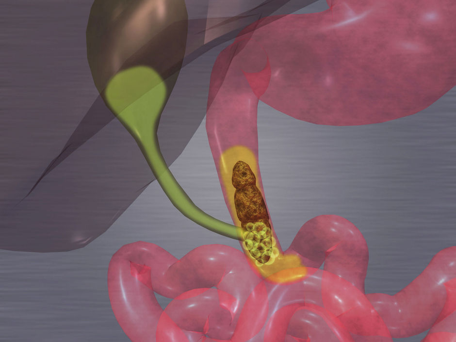 À propos de la sclérose systémique dans le tractus gastro-intestinal