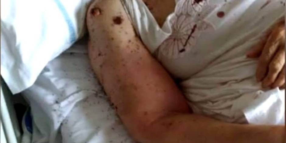 En Italie, un lit d'hôpital infesté de fourmis