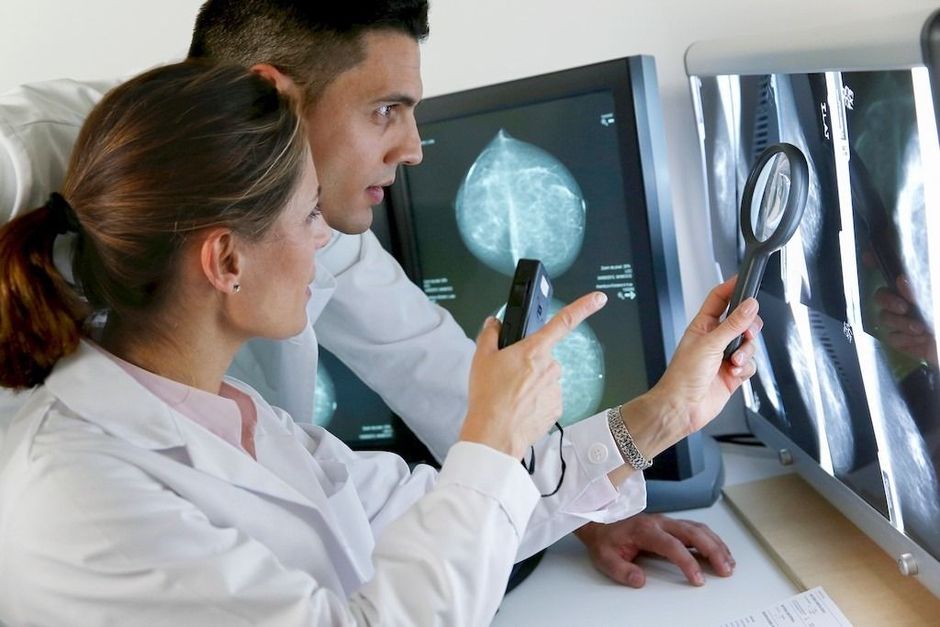 Comparaison des recommandations de dépistage pour la mammographie