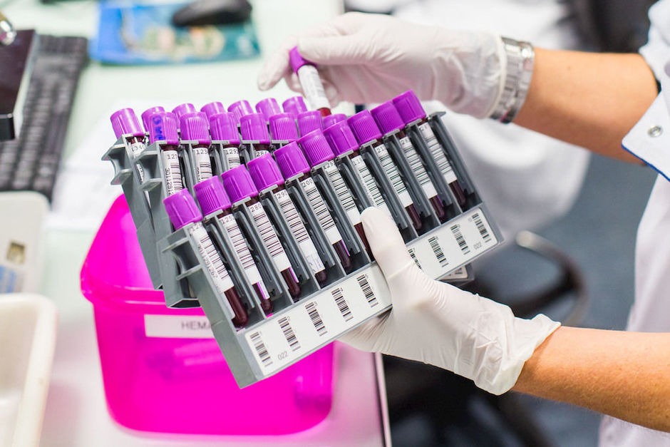 Détecter et localiser huit types de cancer avec un test sanguin multianalyte