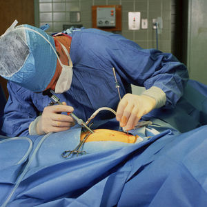 Cancer du côlon : la chirurgie laparoscopique donne de meilleurs résultats