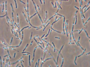 Infections nosocomiales : la bactérie B. cereus mise en cause