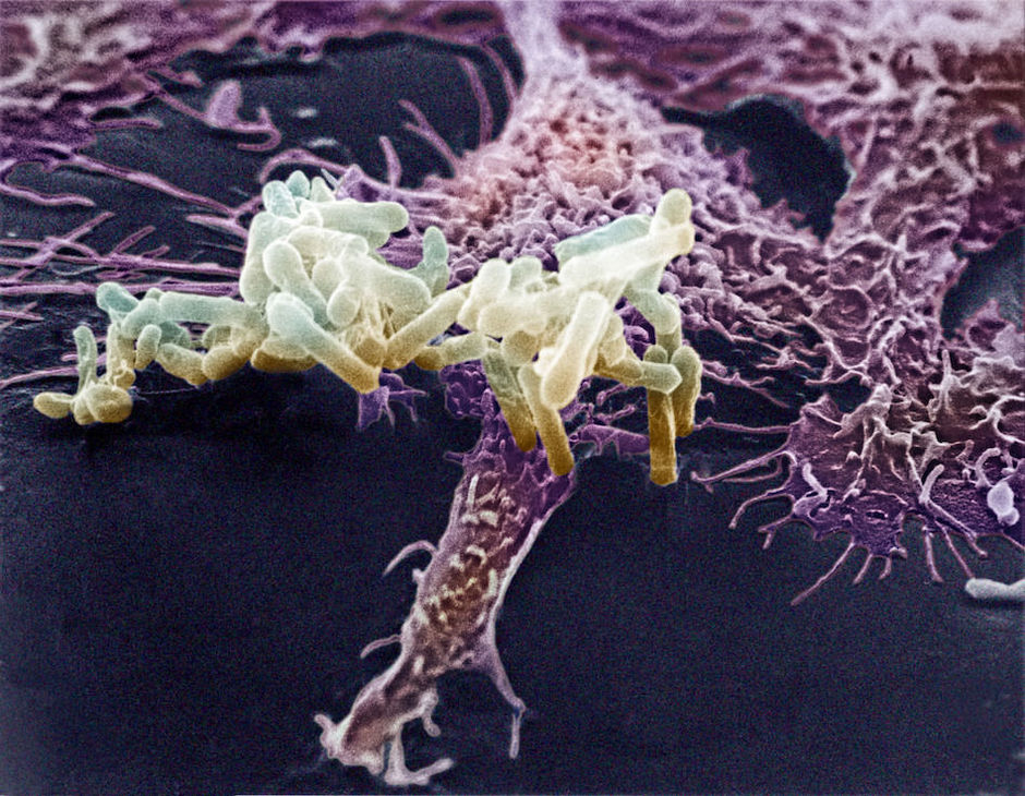 Le microbiome en tant que marqueur de pronostic dans la mucoviscidose