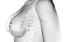 Un soutien-gorge " sous la peau " pourrait révolutionner les opérations mammaires