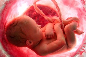 Personnalité de l'enfant mort né : les médecins partagés quant aux menaces sur le droit à l'avortement