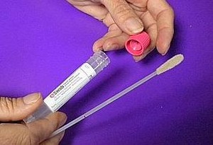 Cancer du col de l'utérus : l'ISP recommande la prudence à propos des kits d'auto-prélèvement