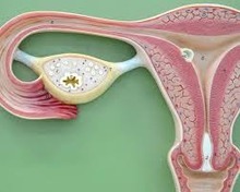 L'utilisation d'aspirine et d'AINS réduit le risque de cancer de l'ovaire 