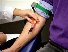 La résistance à l'enzalutamide prédictible par un test sanguin ?