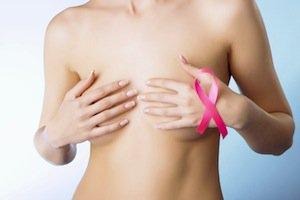 La mastectomie controlatérale prophylactique n'est pas toujours justifiée