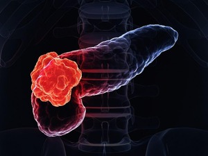 Immunothérapie du cancer du pancréas : une étude préclinique impressionnante