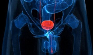 Un nouveau modèle de dépistage du cancer de la prostate 